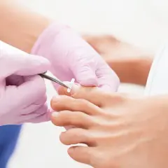 Podolog z różowymi rękawiczkami zakłada specjalny klips na paznokieć u stopy, aby zapobiec wrastaniu. Czy zastrzał można przebić? Nie, to metoda korekcji.
