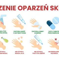 Ilustracja pokazuje, jak leczyć poparzoną rękę: chłodna woda, maść z antybiotykiem, zimny kompres, tabletki przeciwbólowe i aloes. Unikaj masła, jajek, pasty do zębów, przekłuwania pęcherzy i lodu.