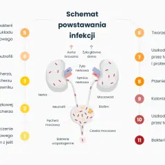 Schemat powstawania infekcji dróg moczowych, od zanieczyszczenia do bakteriemii. Proces obejmuje kolonizację, zapalenie pęcherza i nerek, prowadząc do zapalenia dolnych dróg moczowych.