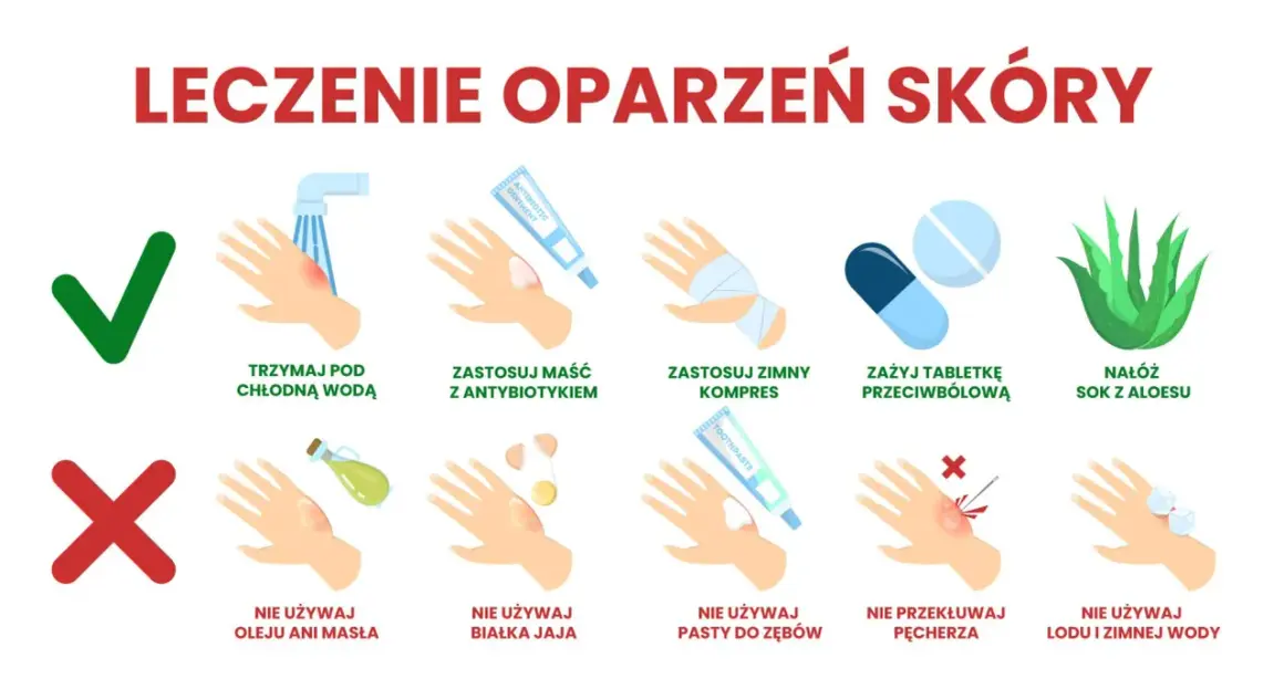 Leczenie oparzeń wrzątkiem: chłodna woda, maść z antybiotykiem, zimny kompres, tabletki przeciwbólowe, aloes. Unikaj oleju, białka jaja, pasty do zębów, lodu.