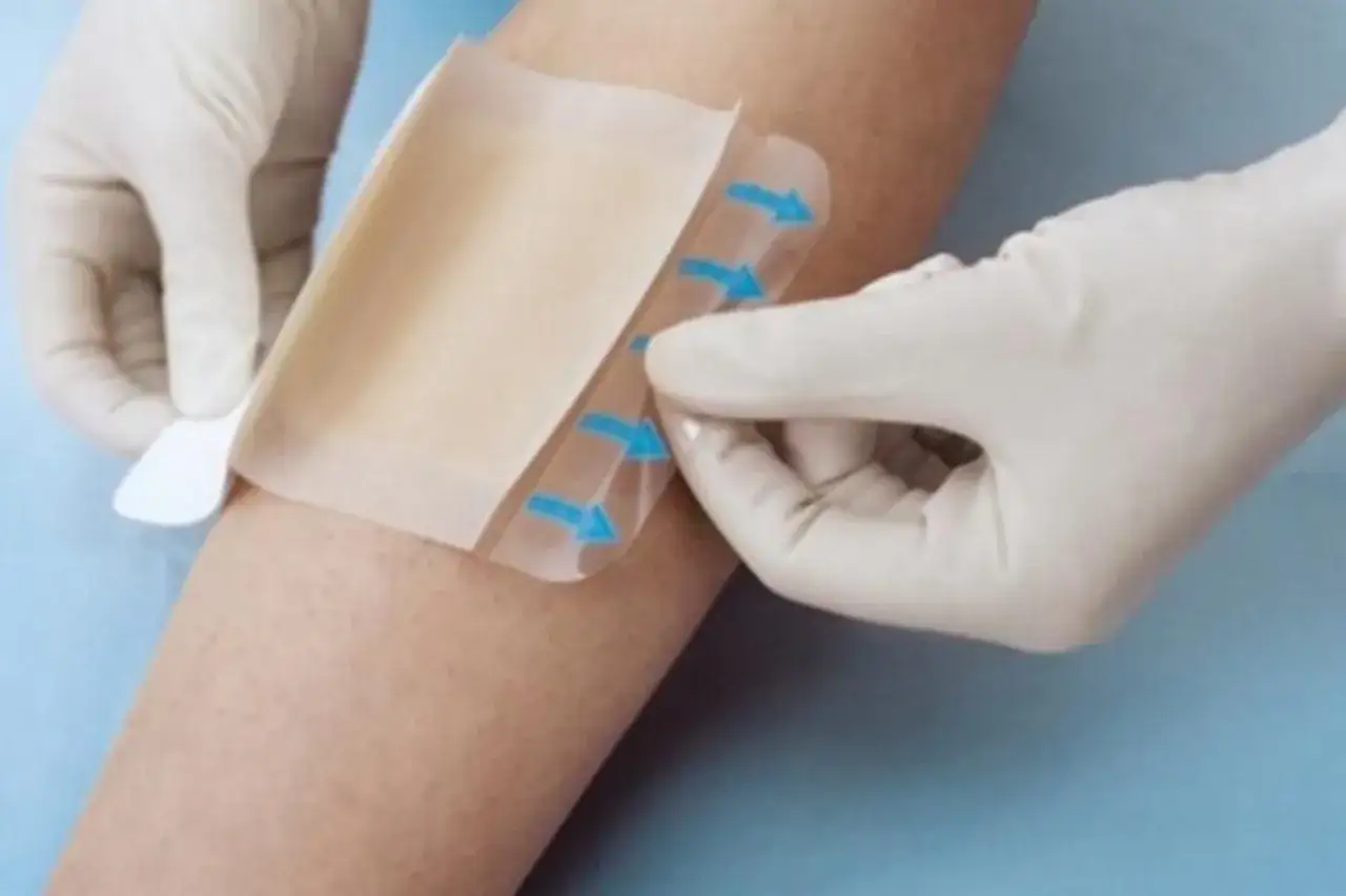 Rękawiczki medyczne zdejmują plaster z rany. Wskazówki na plastrze pokazują, kiedy zdjąć.