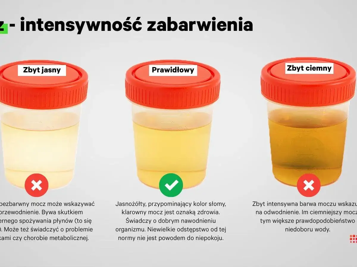 Trzy próbki moczu: zbyt jasny, prawidłowy i zbyt ciemny. Zbyt ciemny mocz może oznaczać odwodnienie i niedobór wody.