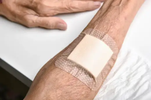 Opatrunki ze srebrem na rany - Kiedy mają sens?